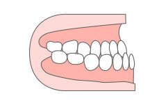 下の歯が前に出ている